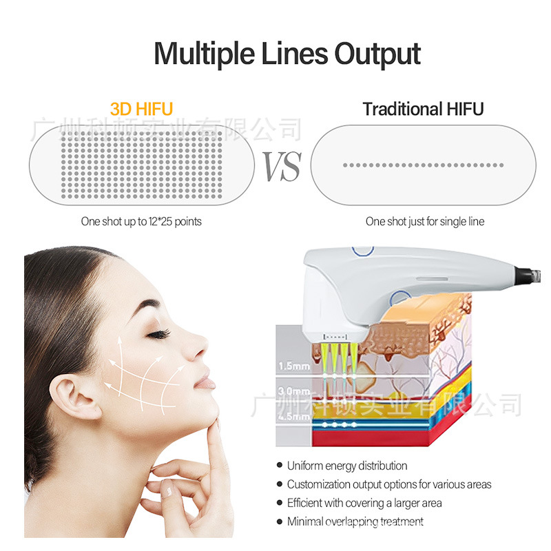 Аппарат для лифтинга лица и тела HIFU + RF MFU01