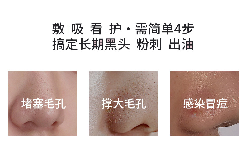 吸黑头仪器