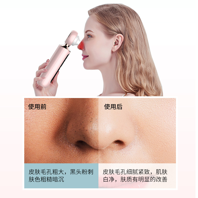 Вакуумный очиститель пор с увеличительным стеклом Blackhead Instrument